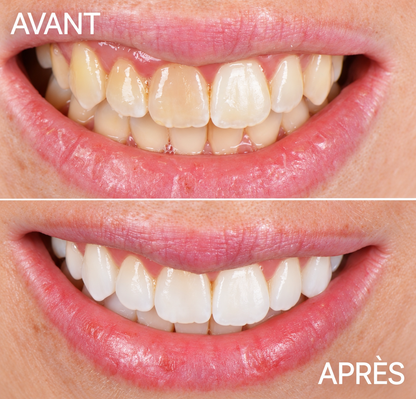 Dentifrice blanchissant naturel – Livia Signature, photo 2